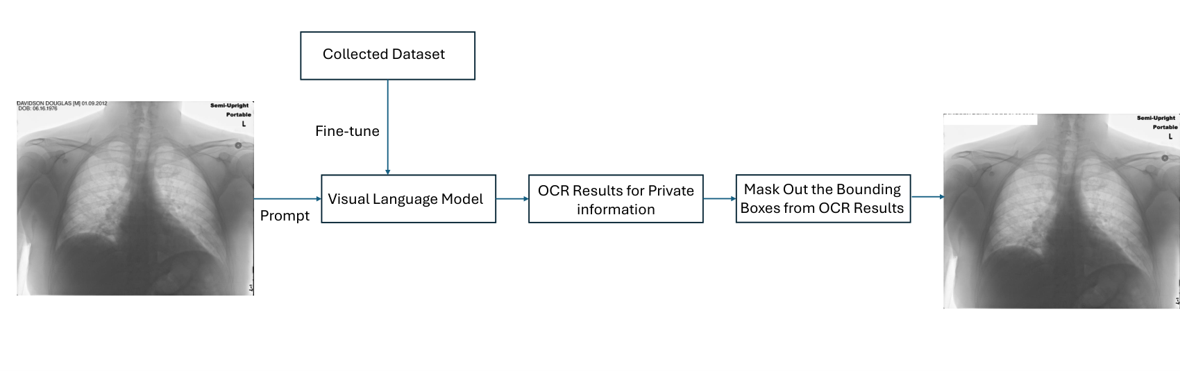 The de-identification pipeline